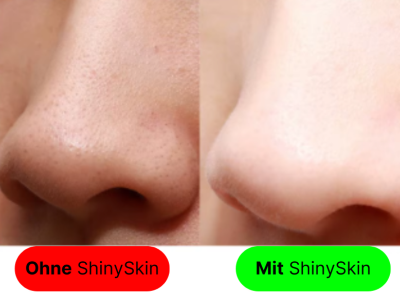 ShinySkin - Gesichtsreinigung